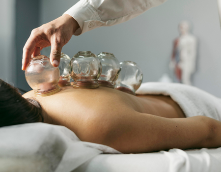 Hacamat/Kupa Tedavisi